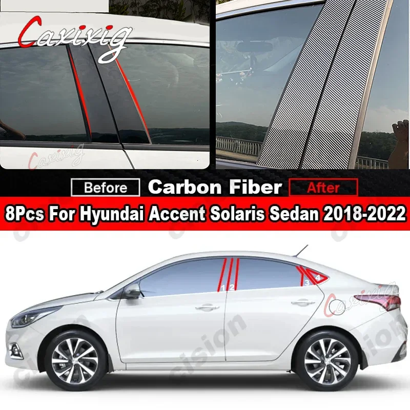 Cubierta pilar fibra de carbono – Hyundai Accent Solaris 2018-2022 - imagen 2