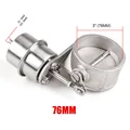 76MM